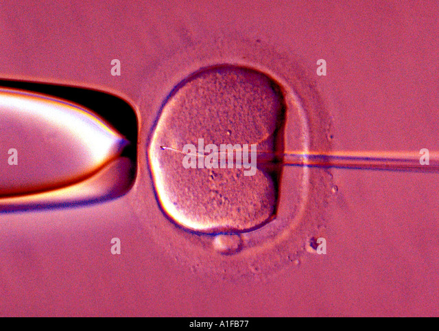 artificial-insemination-of-human-female-