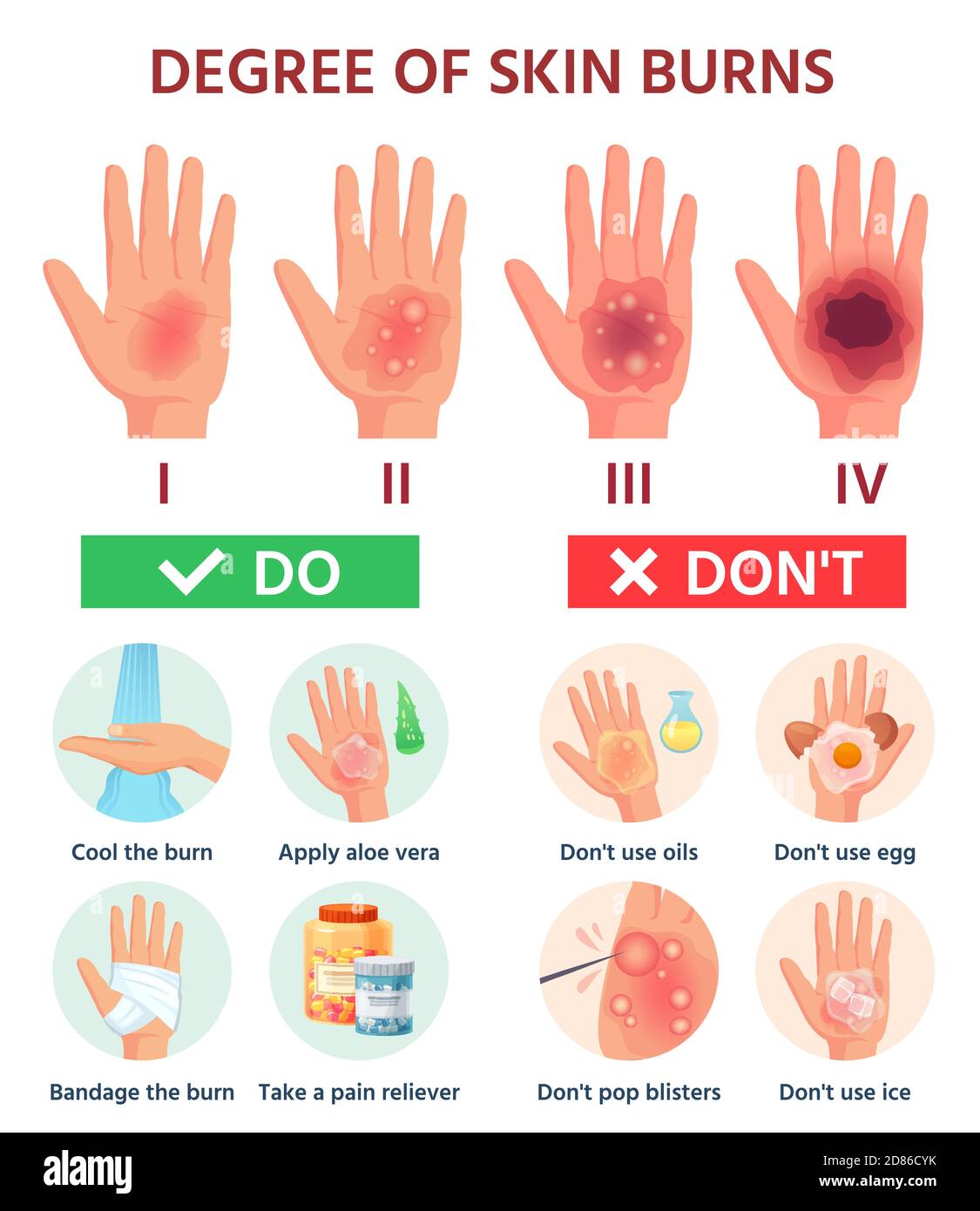 All 99+ Images how to treat blisters on hands from a burn Latest