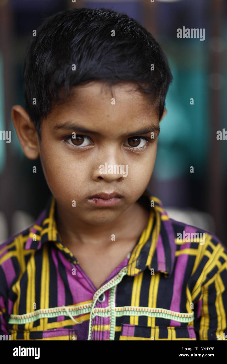 April 17, 2014 - Dhaka, Bangladesh - Hemophilia patient Rafi age of 6 ...