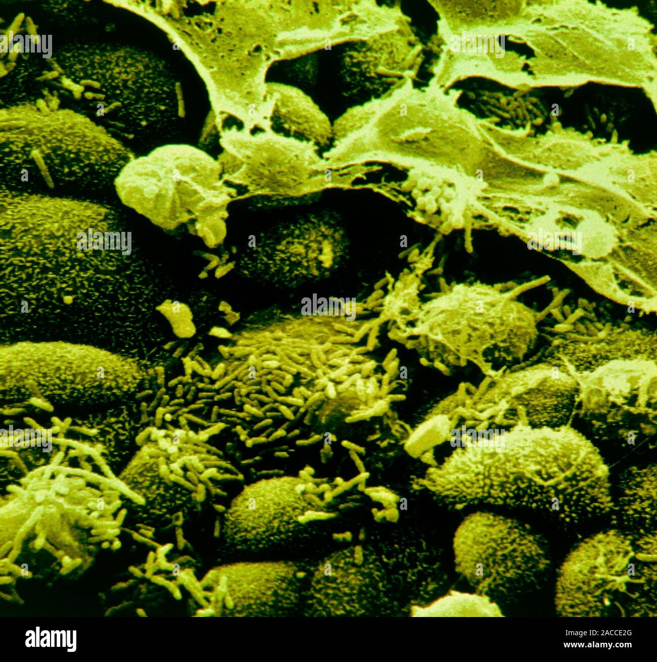 Haemophilus influenzae. Coloured scanning electron micrograph showing ...