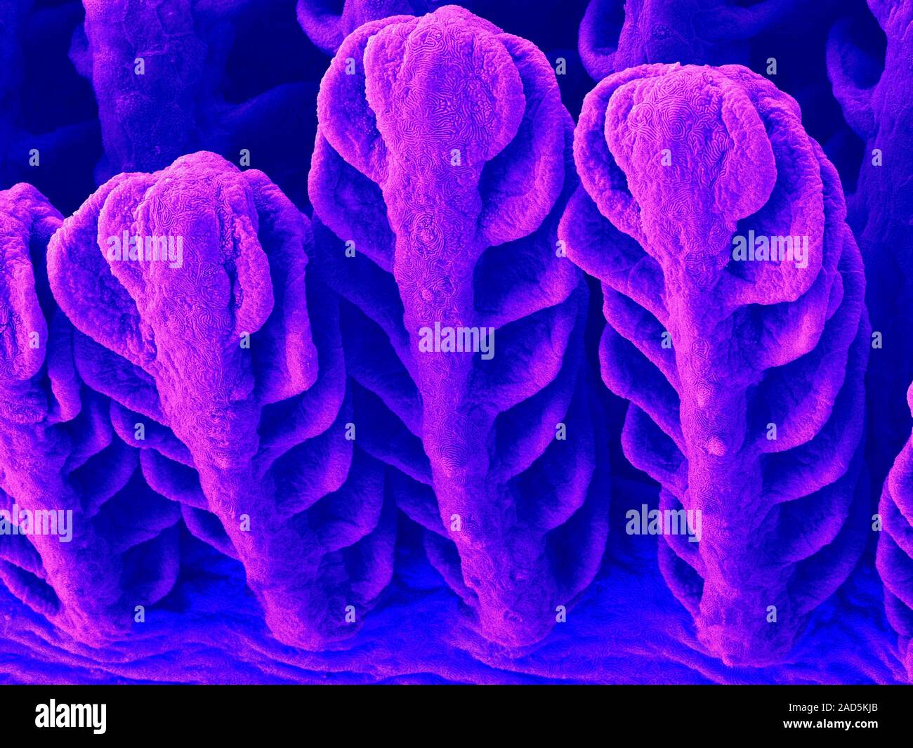 Coloured scanning electron micrograph (SEM) Fresh water goby (Awaous ...